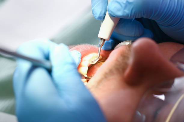 Best Broken or Chipped Tooth Repair in Salyersville, KY