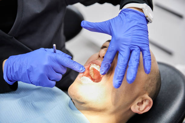 Best Emergency Wisdom Tooth Extraction in Salyersville, KY