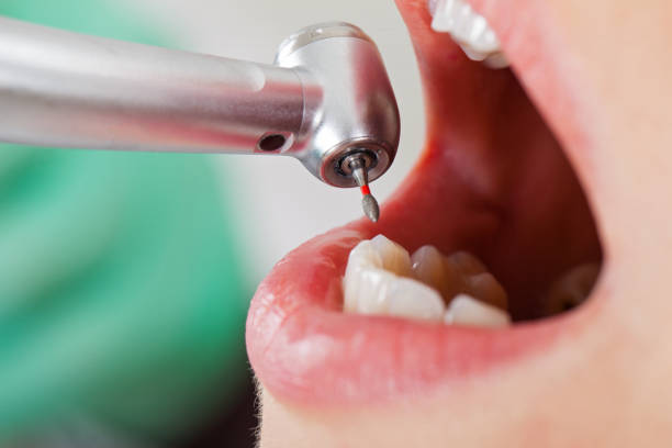 Best Emergency Dental Care for Sports Injuries in Salyersville, KY